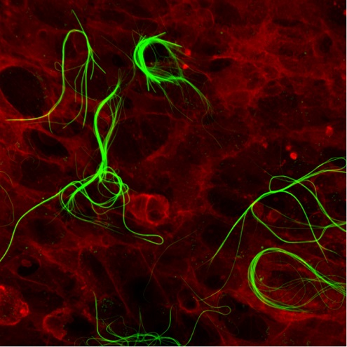 Medicina rigenerativa: la stampa in 3D sarà il futuro degli innesti  cutanei? - Osservatorio Terapie Avanzate